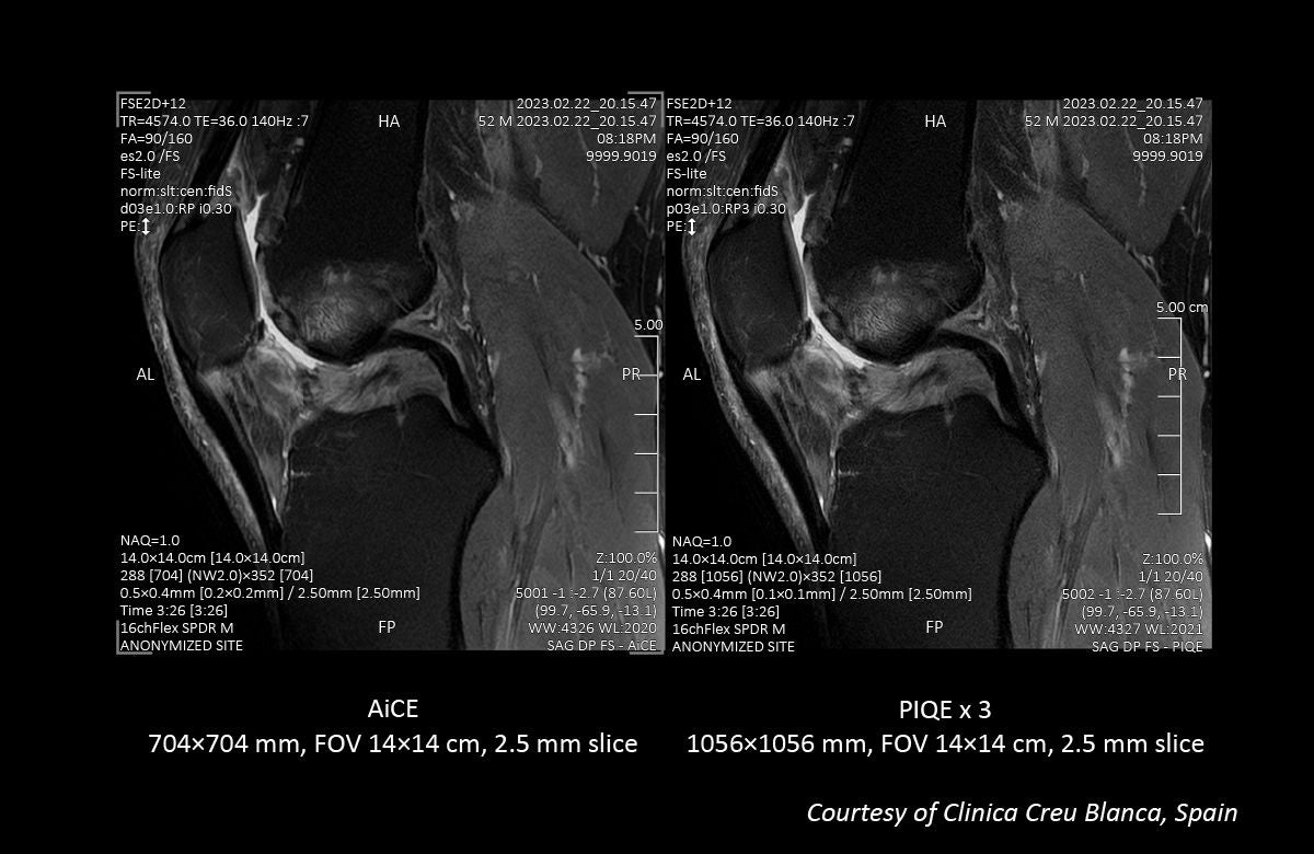 Key Clinical Imaging Tips for V9.0 PIQE Validation Sites in Europe