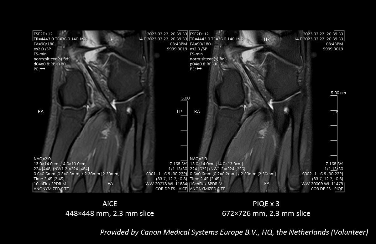 Key Clinical Imaging Tips for V9.0 PIQE Validation Sites in Europe
