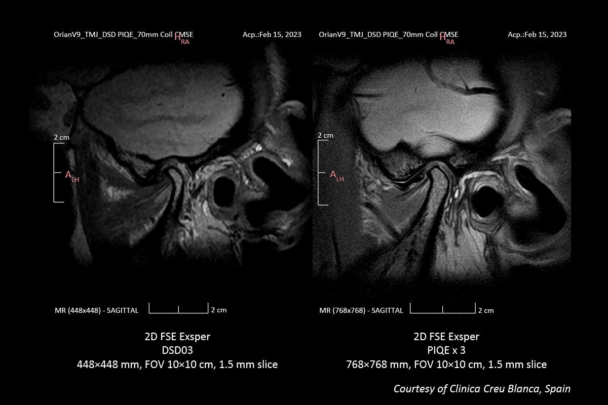 Key Clinical Imaging Tips for V9.0 PIQE Validation Sites in Europe