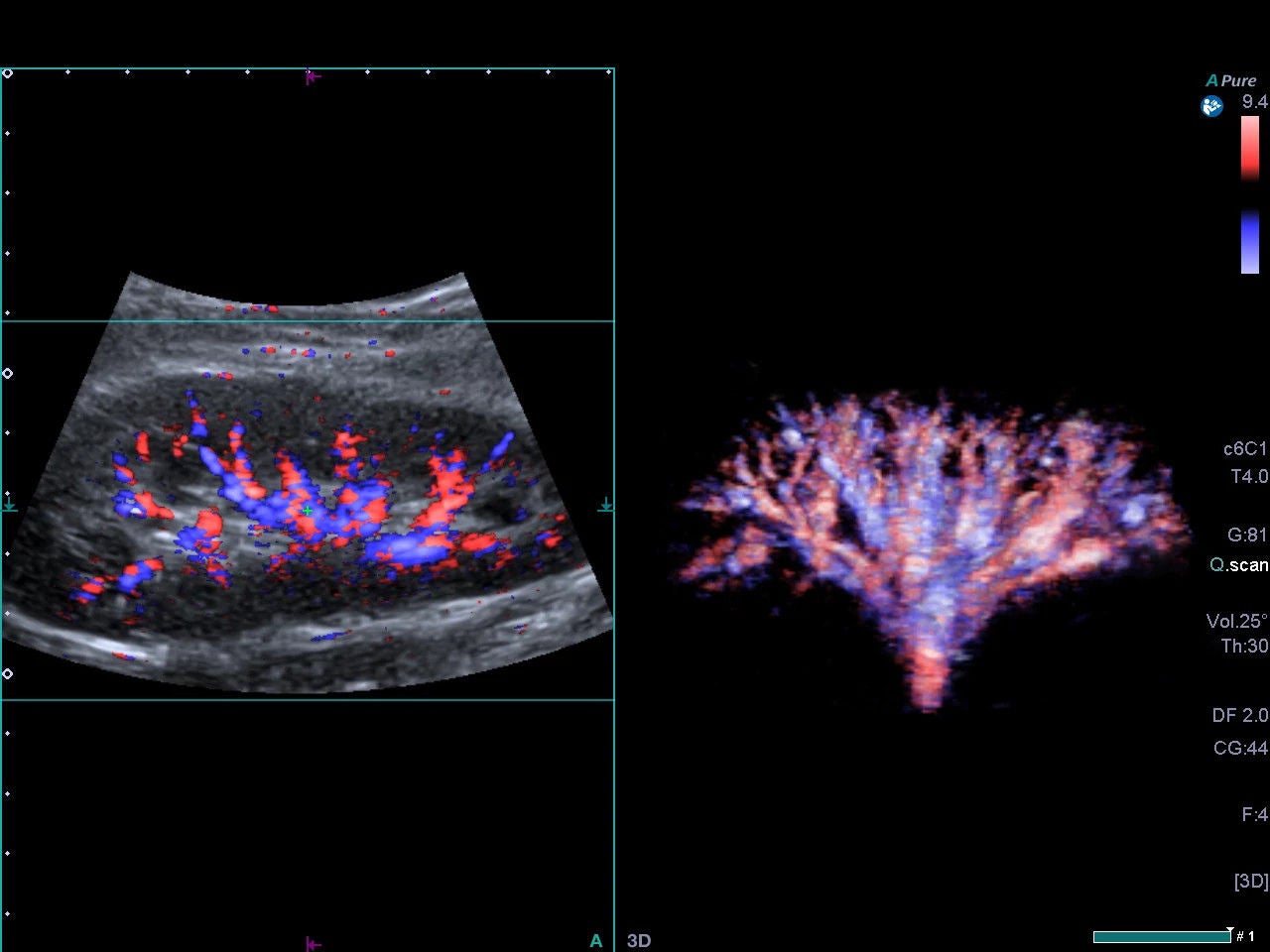 6★Abdomen_Renal-vasculature_Smart3D_375LT.jpg