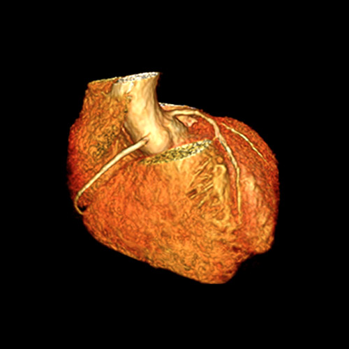 MRI