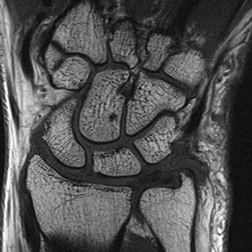 MRI