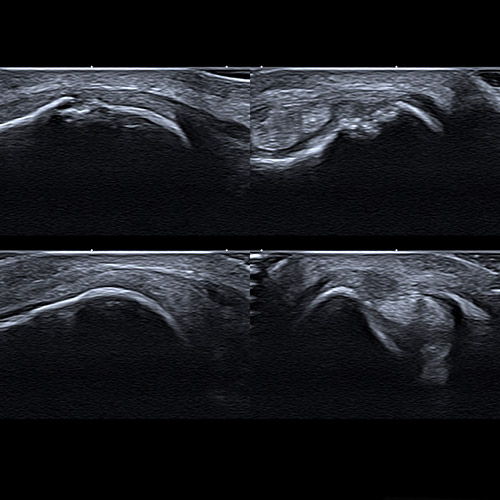 Ultrasound // Quad view