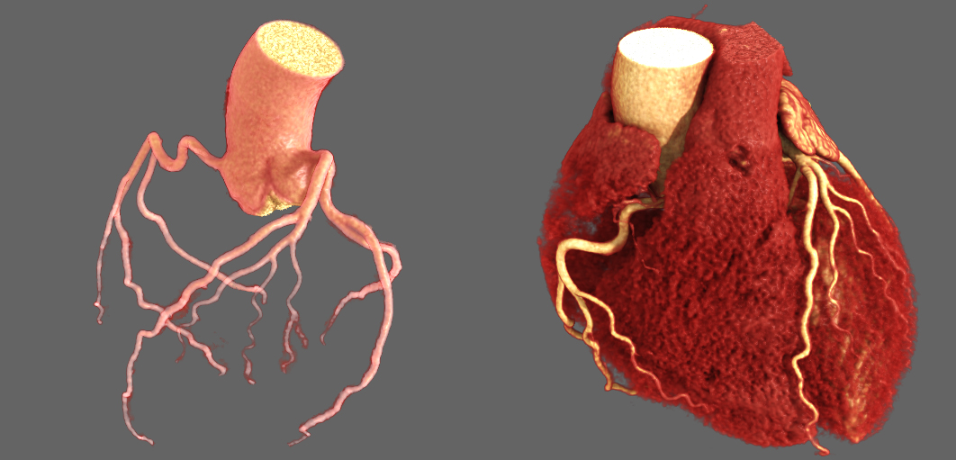 Cardiac